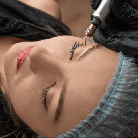 Skin Needlig Consultation - 15  Mins